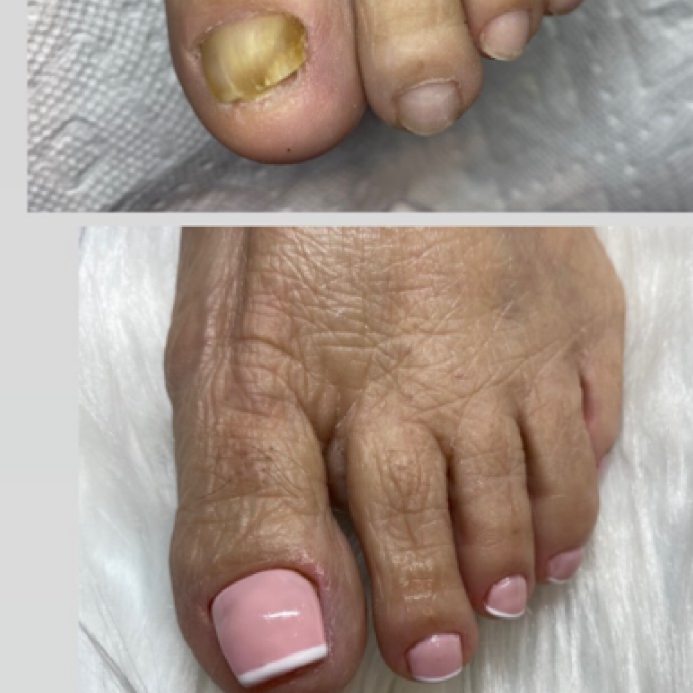Gel Pedi+ toenail reconstruction at Marjorie Zotti in Vineyard Haven, MA