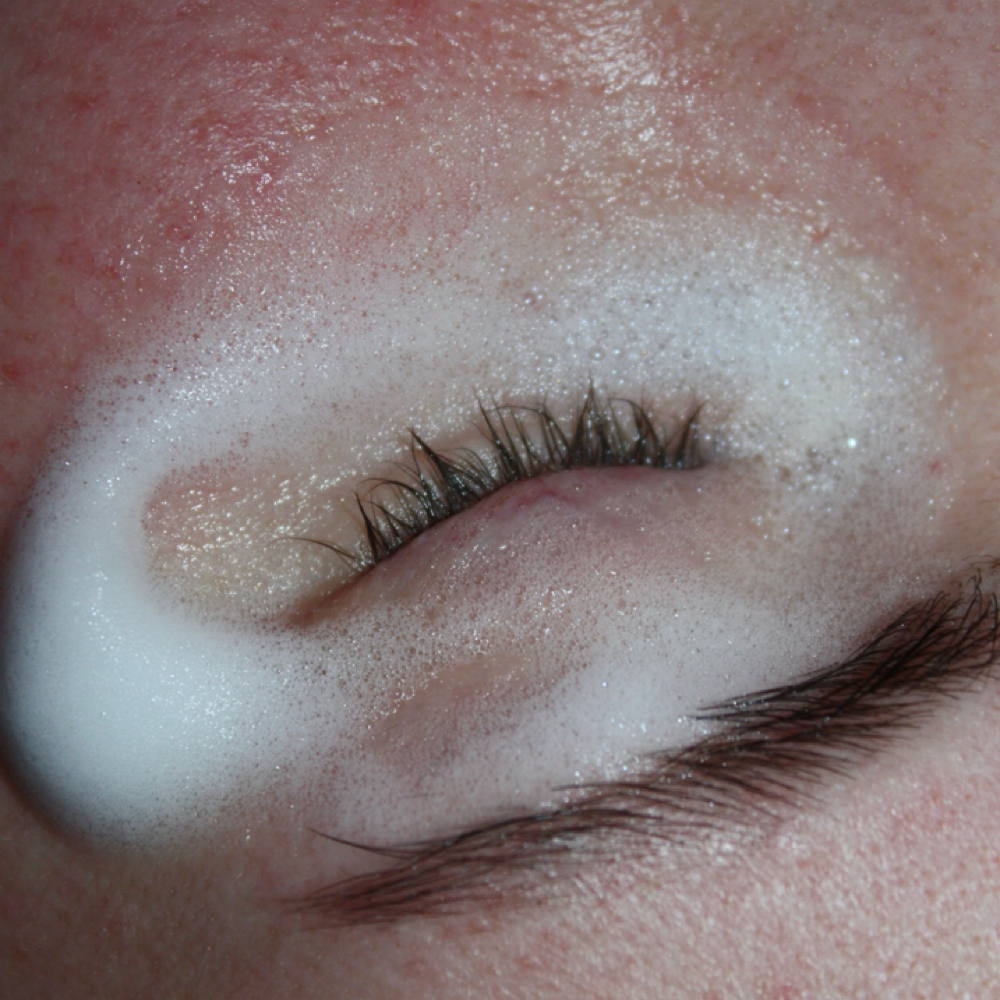 Lash Removal at KateVEsthetics in Milton, DE