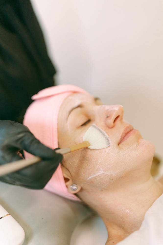 Microdermabrasion Facial