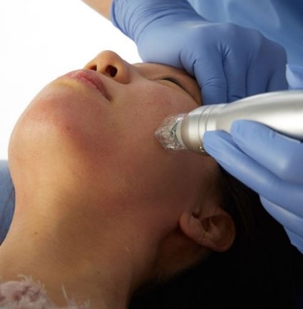 Premium Scarlet RF Microneedling