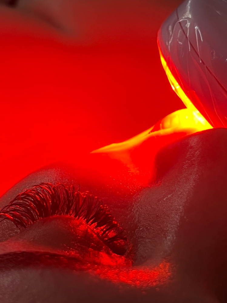 Add On ( RED LIGHT THERAPY)