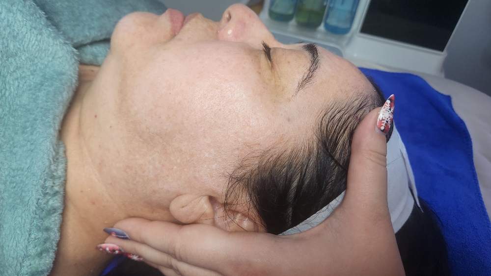 Microderm Facial
