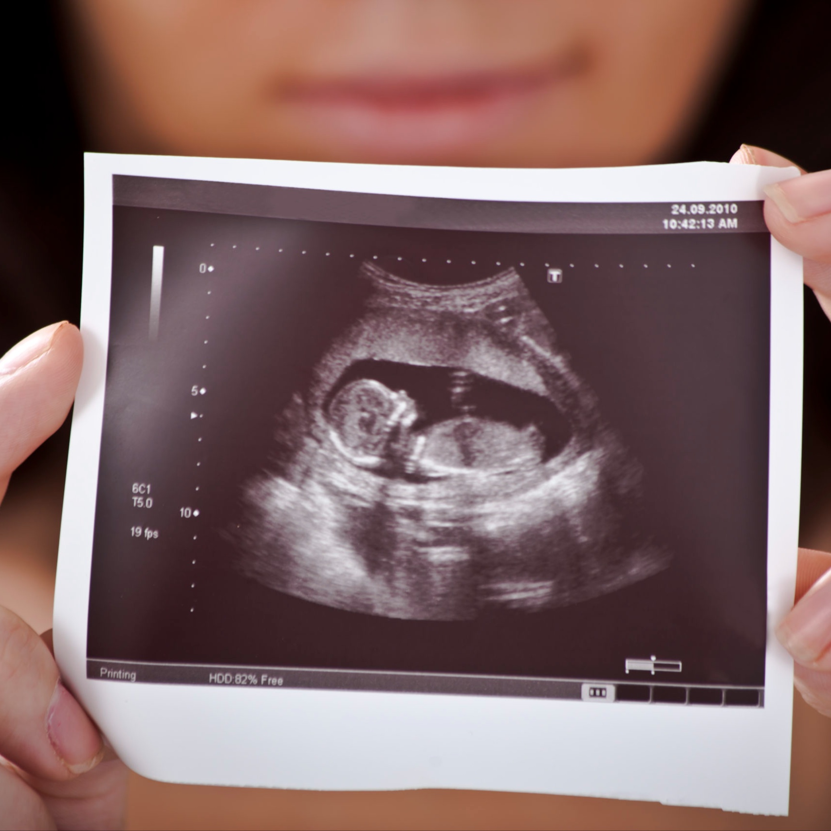 Early Pregnancy Ultrasound at San Bernardino 3D 4D Ultrasound by 4D Special Delivery in San Bernardino, CA