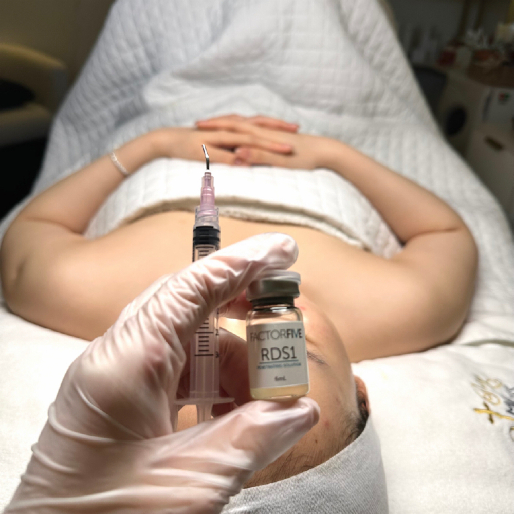 FactorFive Stem Cell Resurfacing at SORA Skin & Ritual House in Peoria, AZ