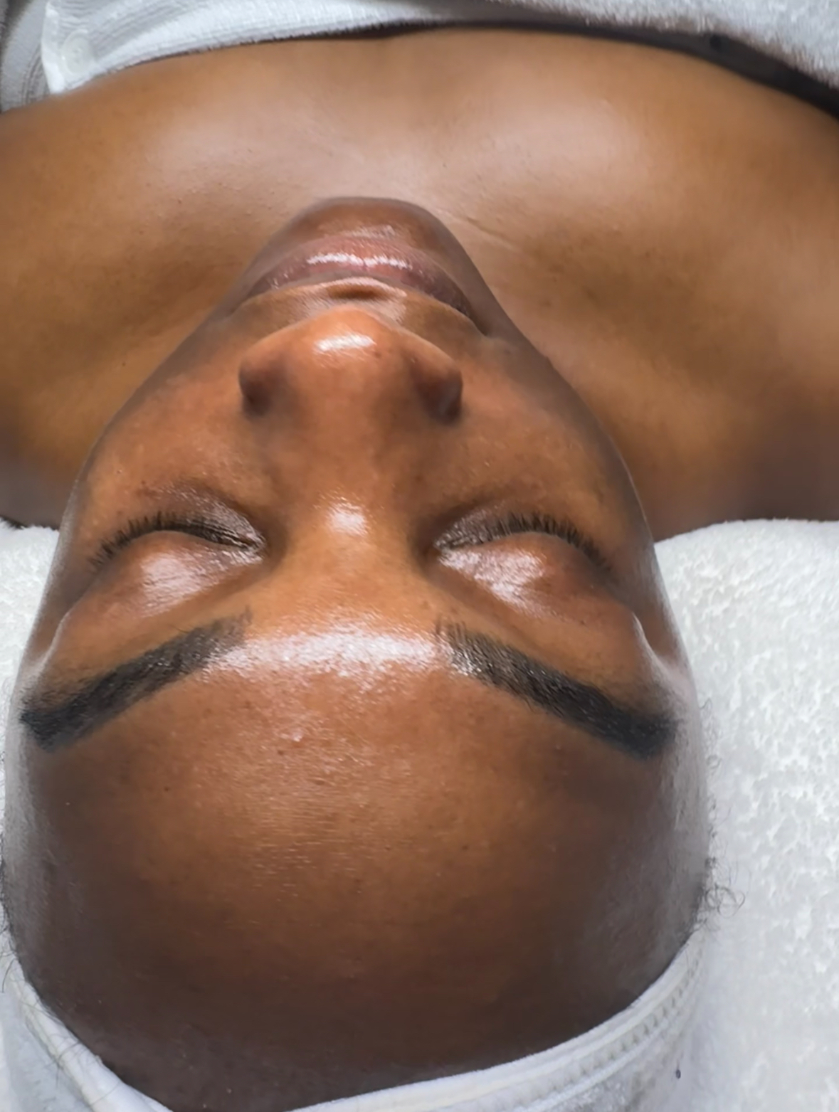 Glow Vitamin C Peel