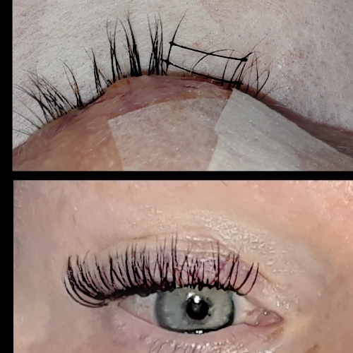LASH REHABILITATION