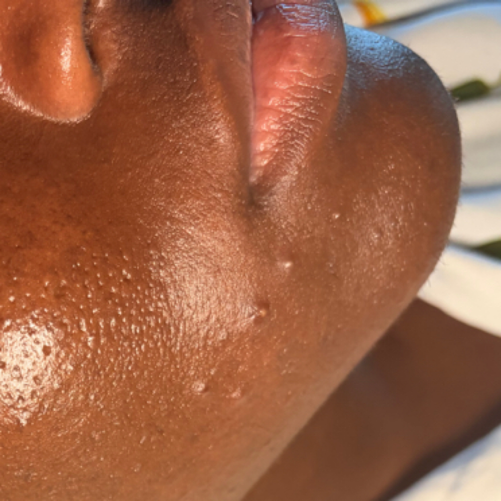 Chin / Jaw WAX at WYN SKIN & BROWS in Dallas, TX