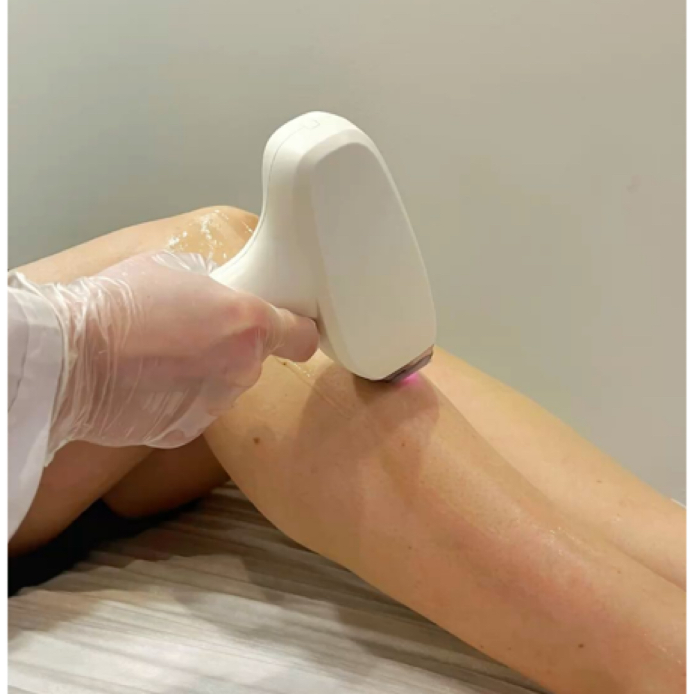 Full Legs Hair Removal (8 Sessions) at Nenusk Aesthetics in Long Island City, NY