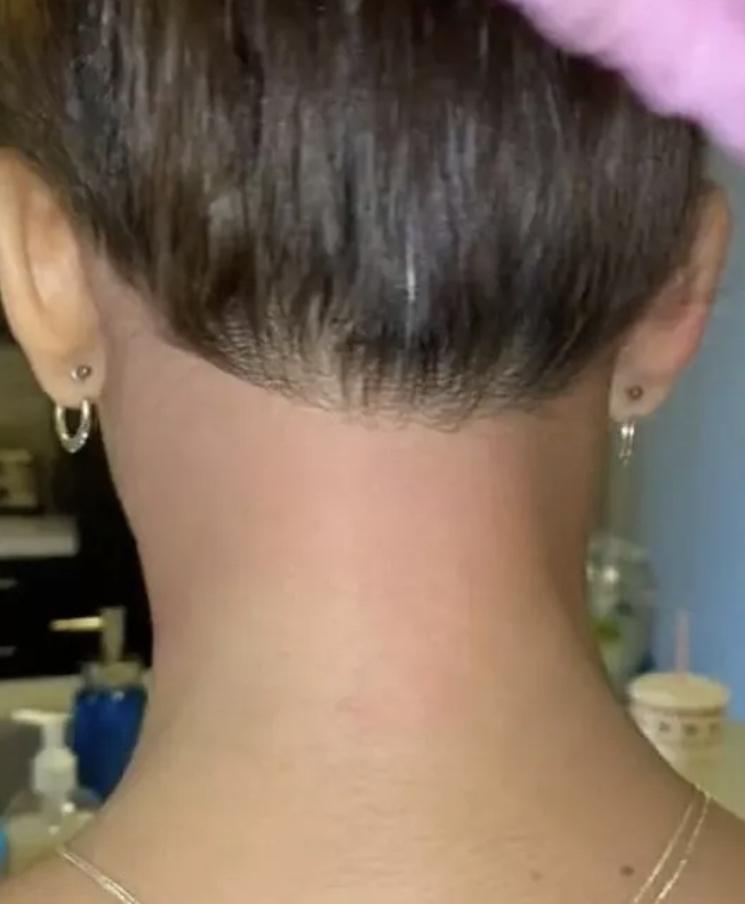 WAXING (NECK WAX)
