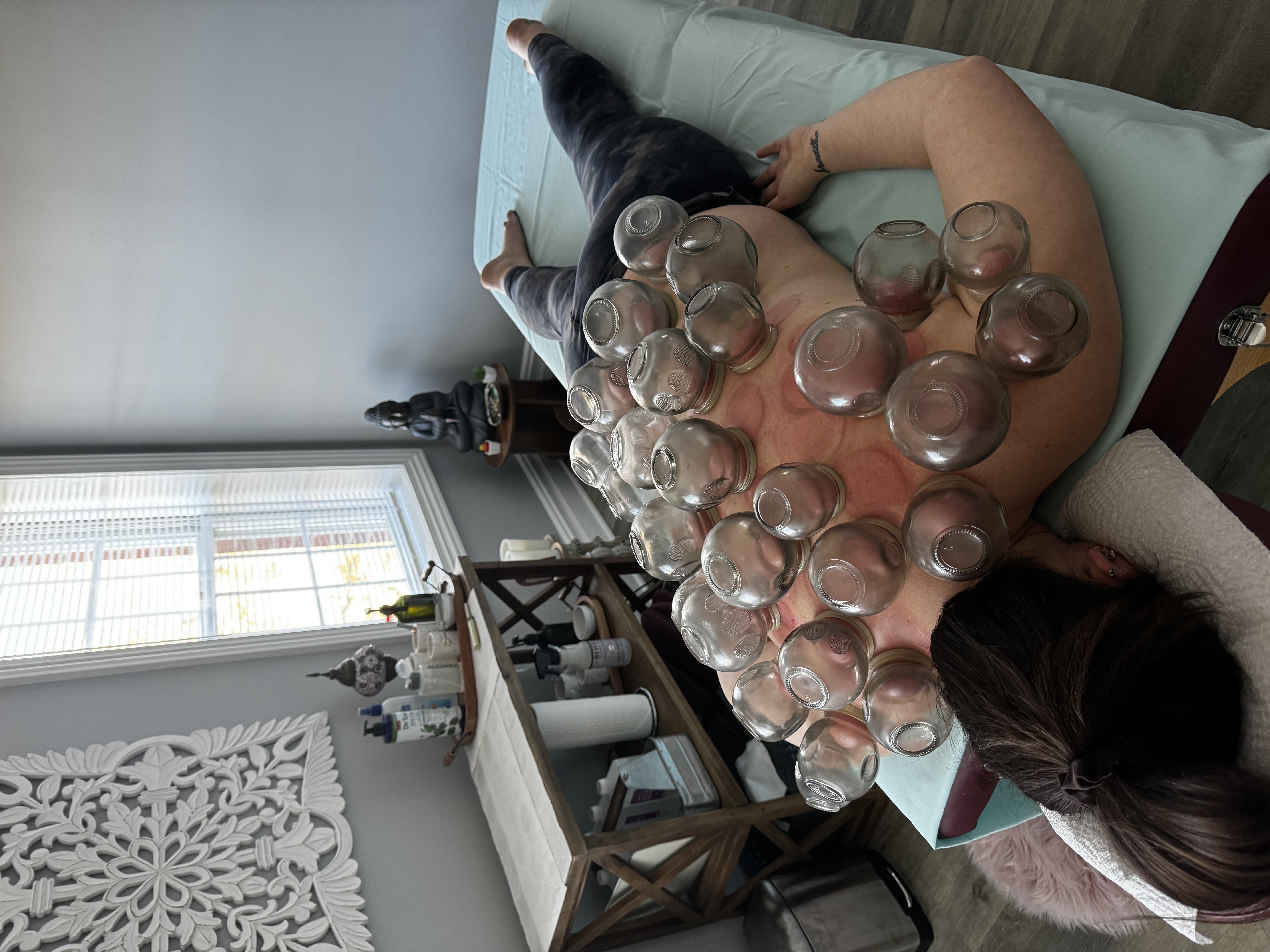 Fire Cupping + Stretch Therapy