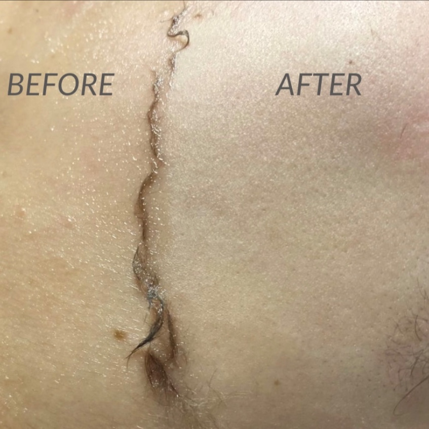 Express Dermaplane🪷 at Soulsthetics in Jacksonville, FL