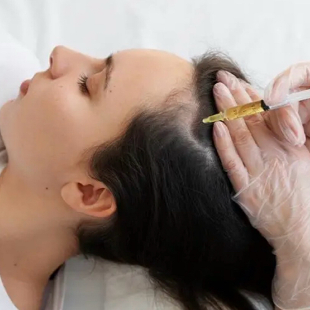 Hair Restoration with PRP at ELITE DERM in Staten Island, NY