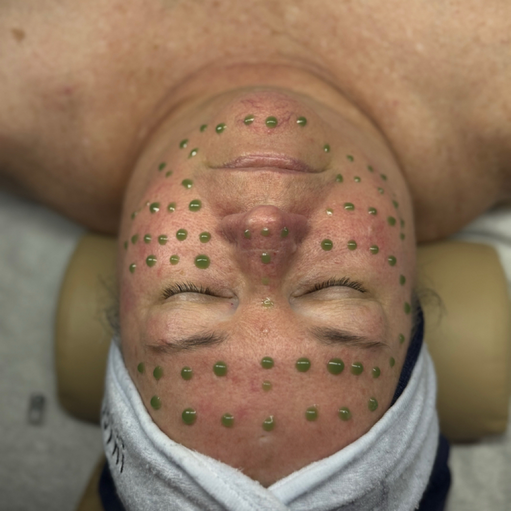 Korean Sensitive Skin Rescue Facial at Serene Skin byWansada in Matthews, NC