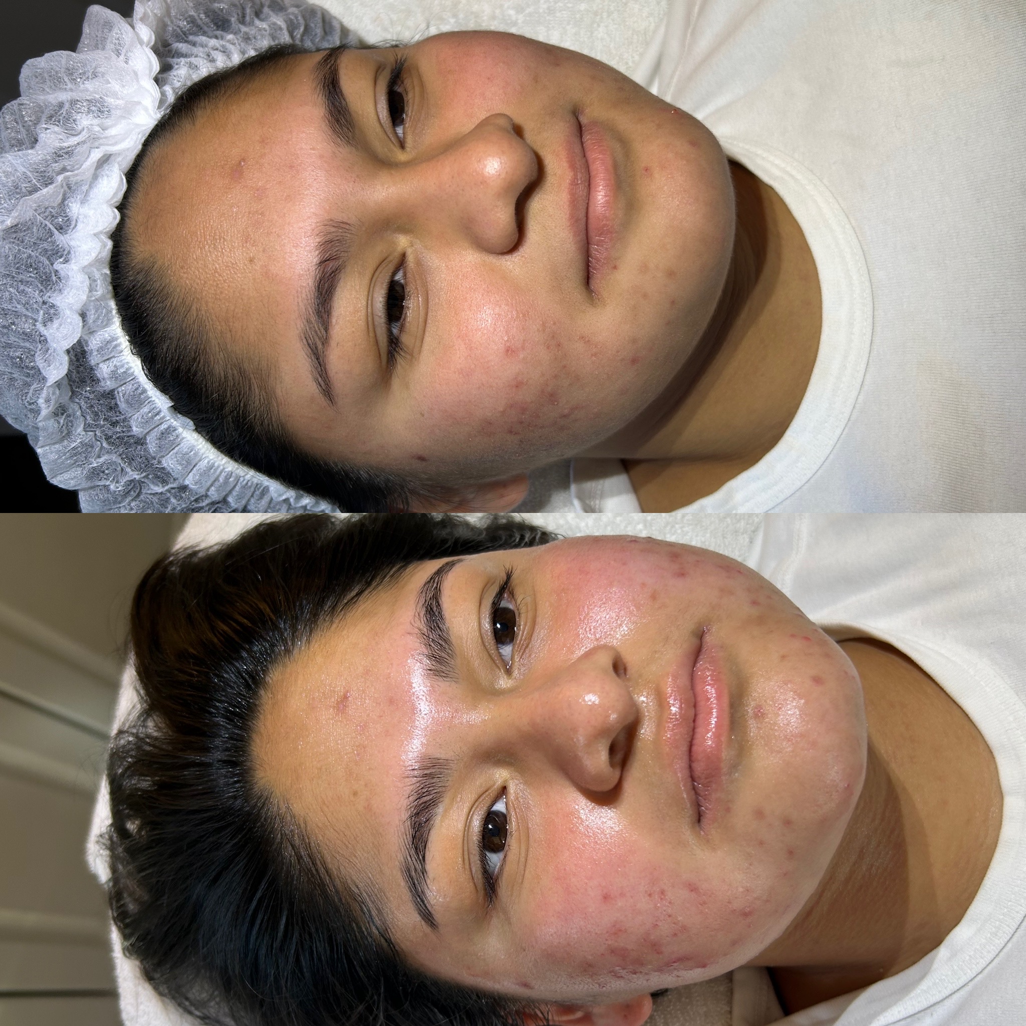 Deep Cleansing Facial