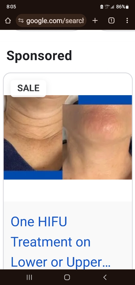 HIFU Face  OR  Neck