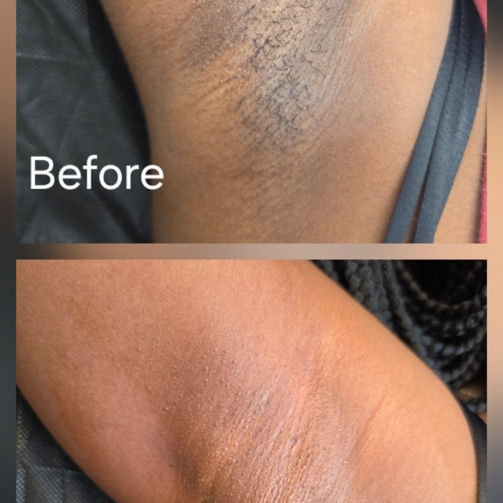 Underarm Wax at LS Wax Studio in Grapevine, TX