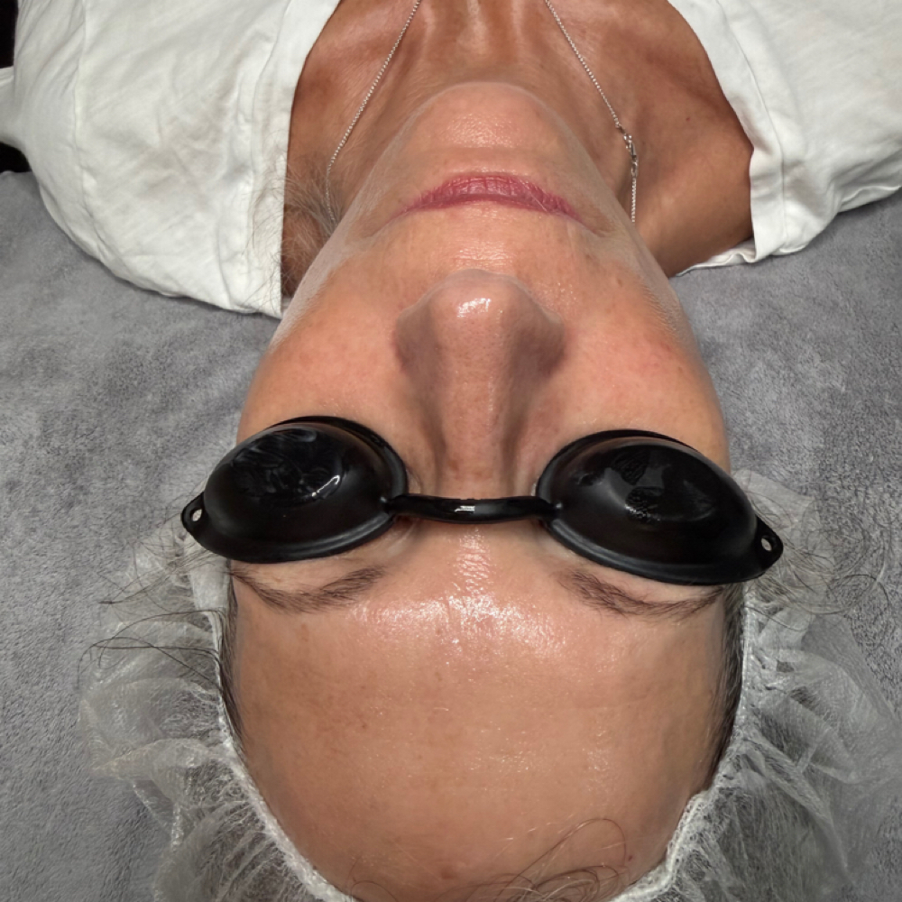 V-line Lifting Facial at Unique U in Port Charlotte, FL