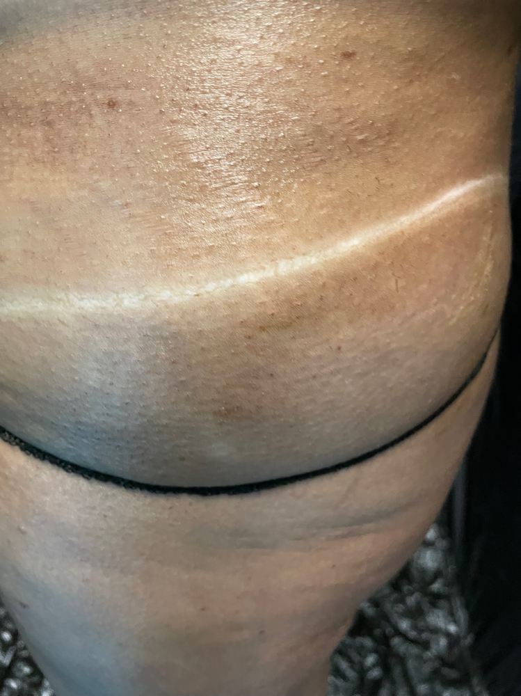 Spray Tan