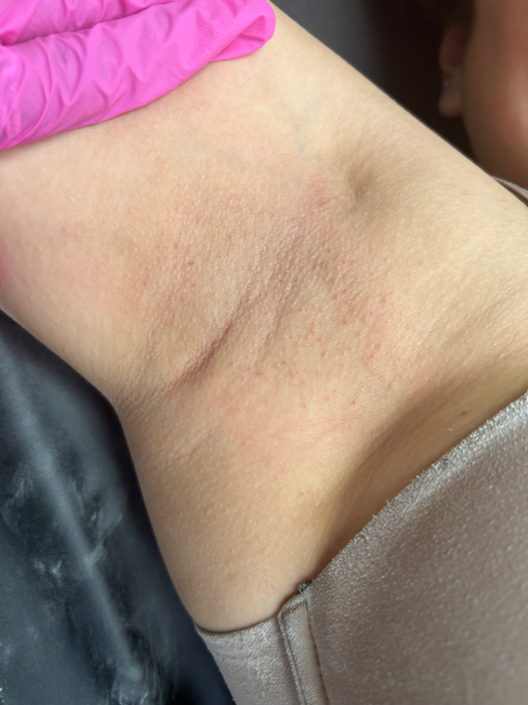 Underarms
