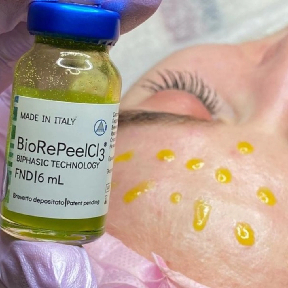 BioRePeel Facial