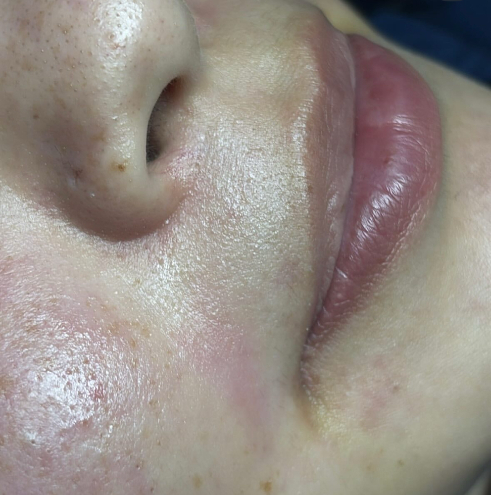 Lip Wax