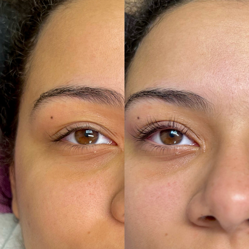 Lash Lift