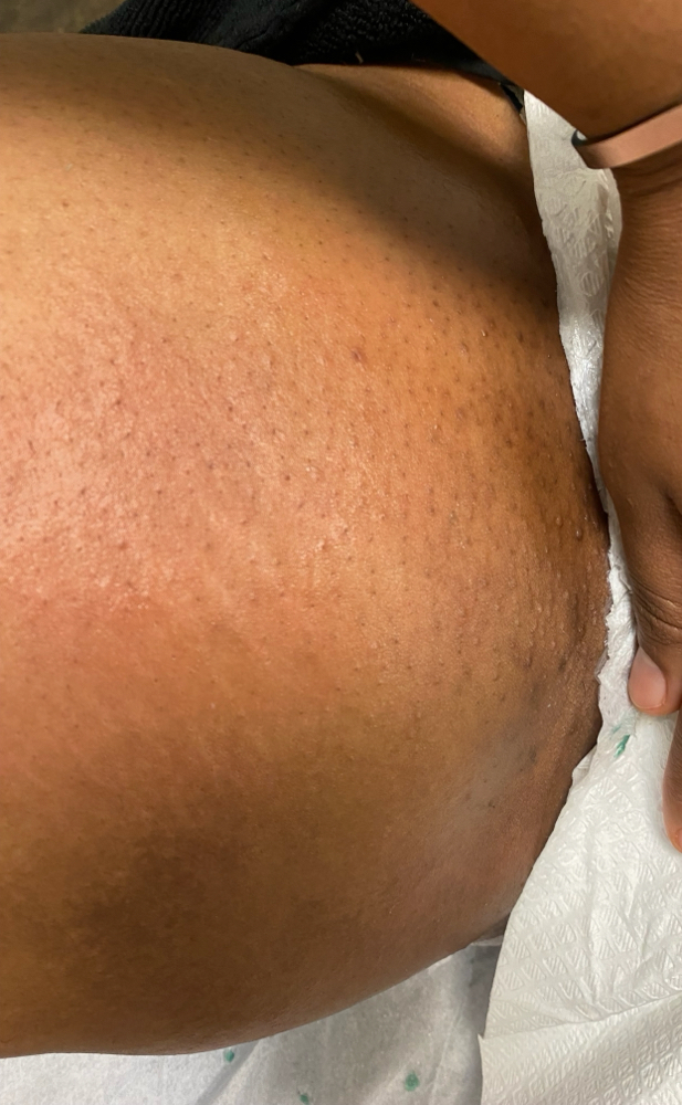 Bikini Wax