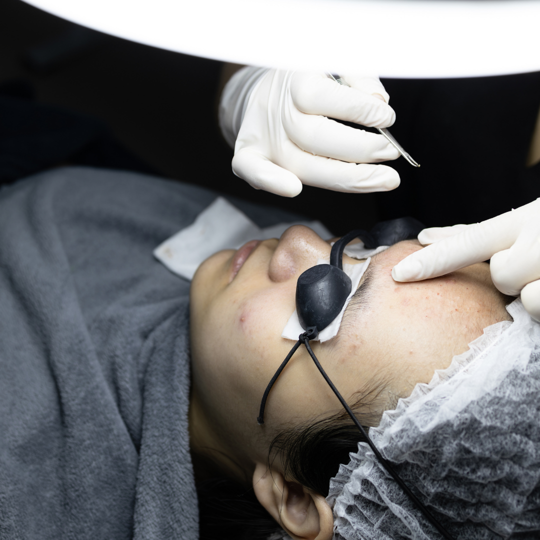 Extractions