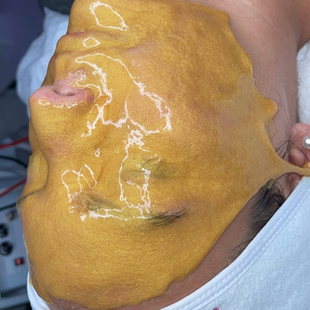 Anti Aging Facial at Mimi Beauty Spa in Dallas, TX