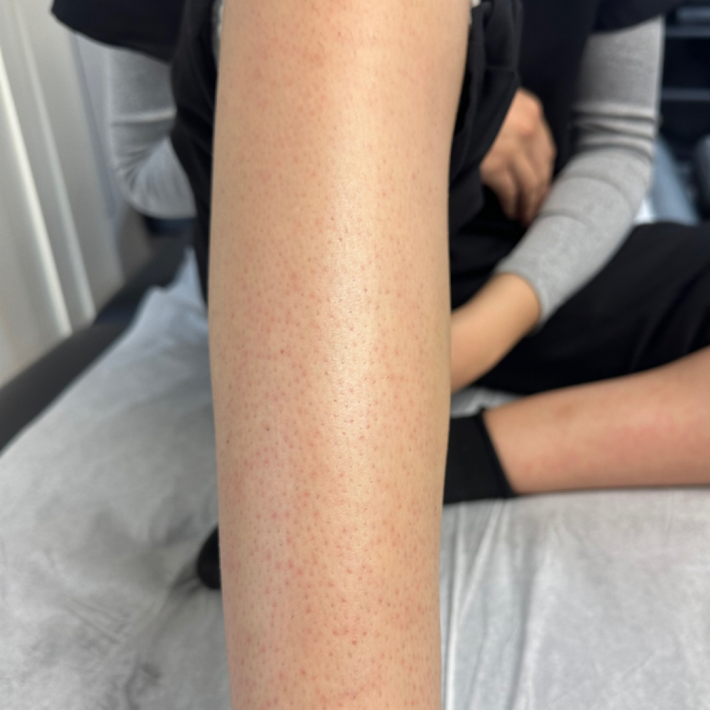 Leg Wax at Liv Beautiful Esthetics in CA, CA