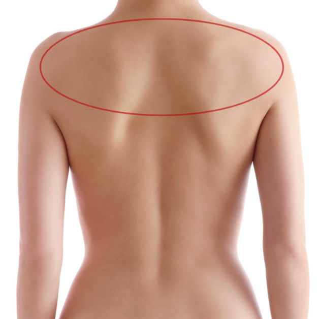 Back Upper at Bareline Aesthetics in Brea, CA