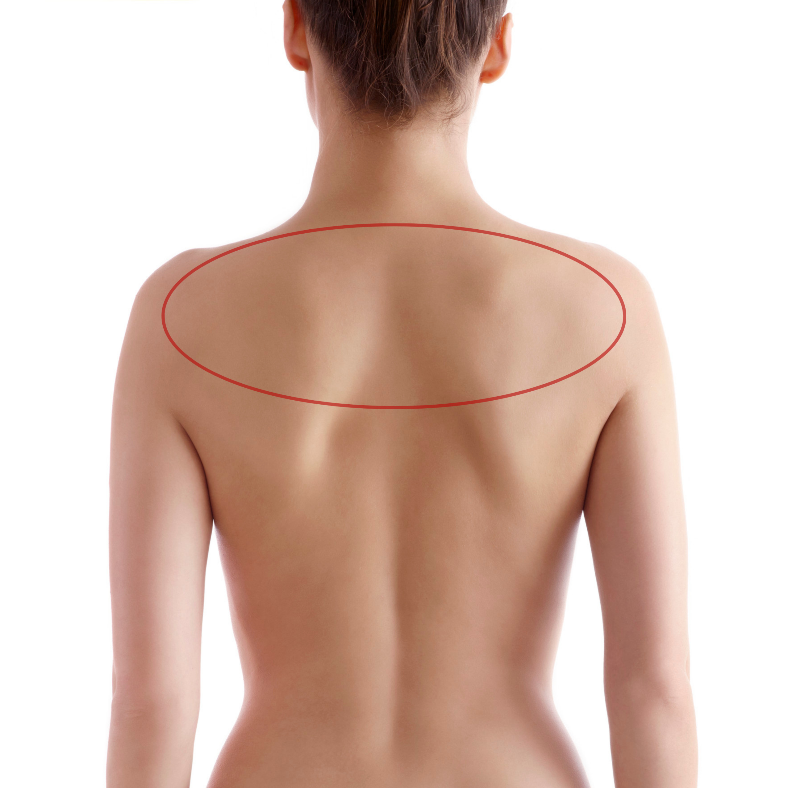 Back Upper at Bareline Aesthetics in Brea, CA