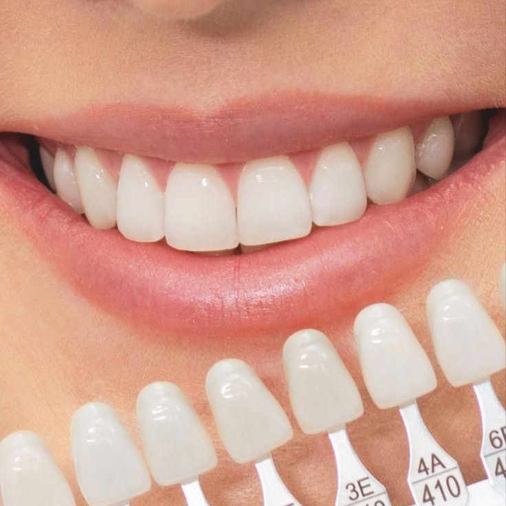 Teeth Whitening & Gem Classes at All in one beauti and Training studio in Brooklyn, NY