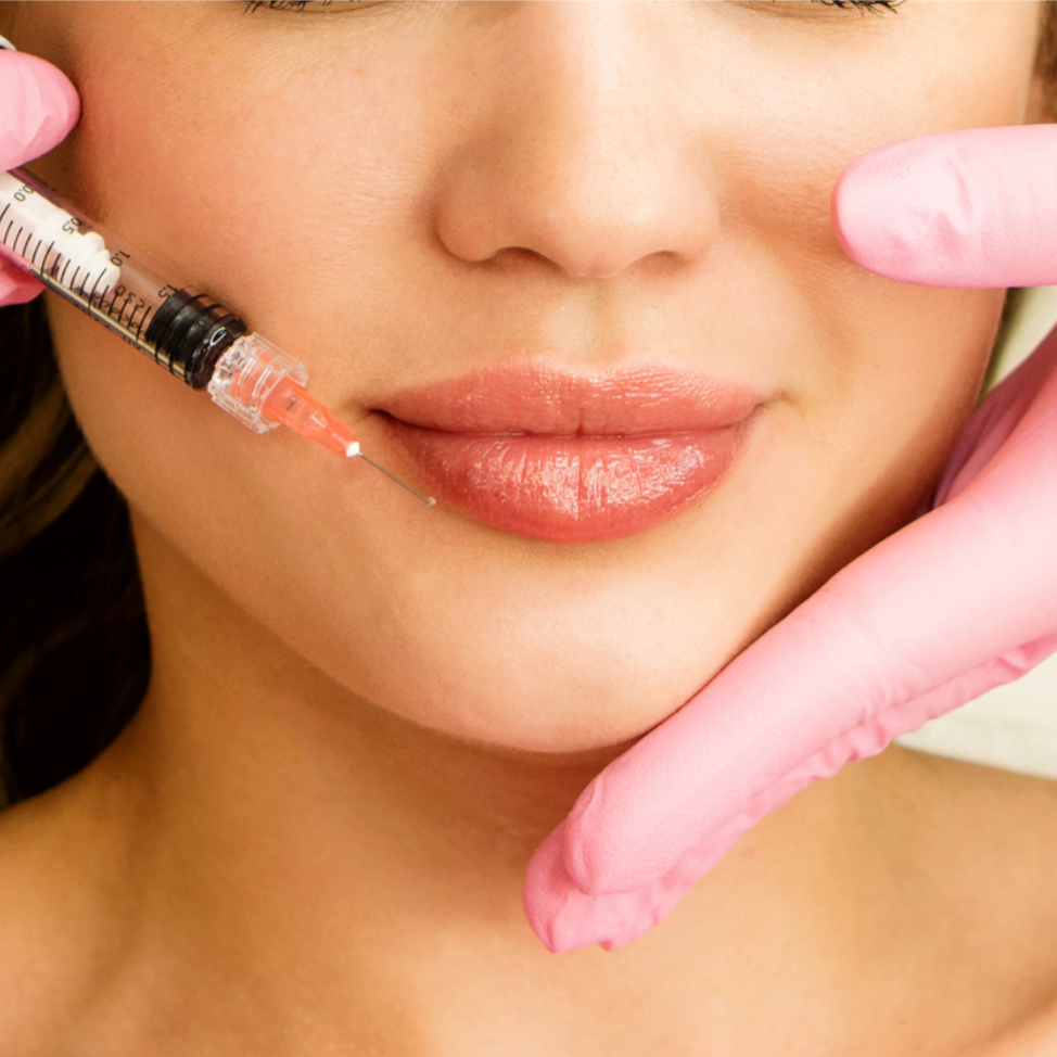 Lip Flip at JENNVIE Med Spa in Westport, CT