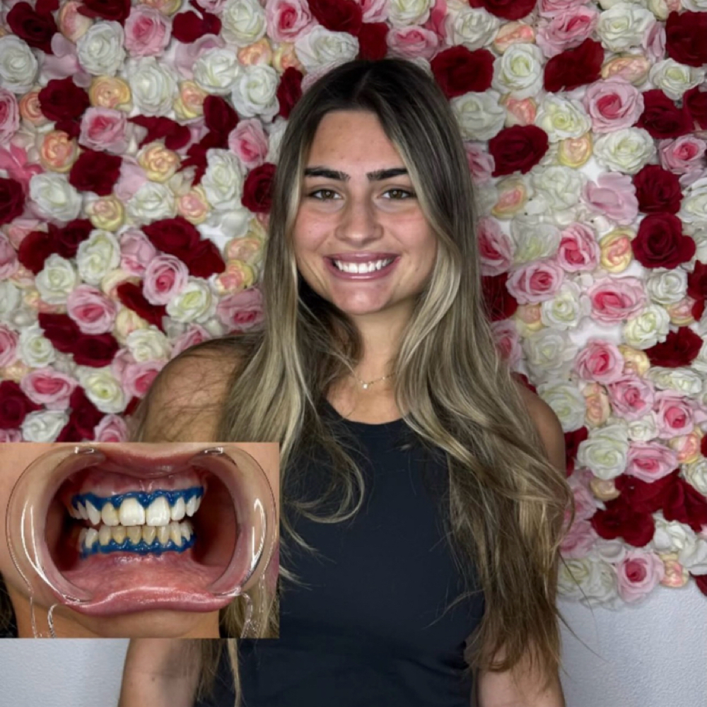 60min (Most Booked) at Luxe Glow Smiles in orlando, FL