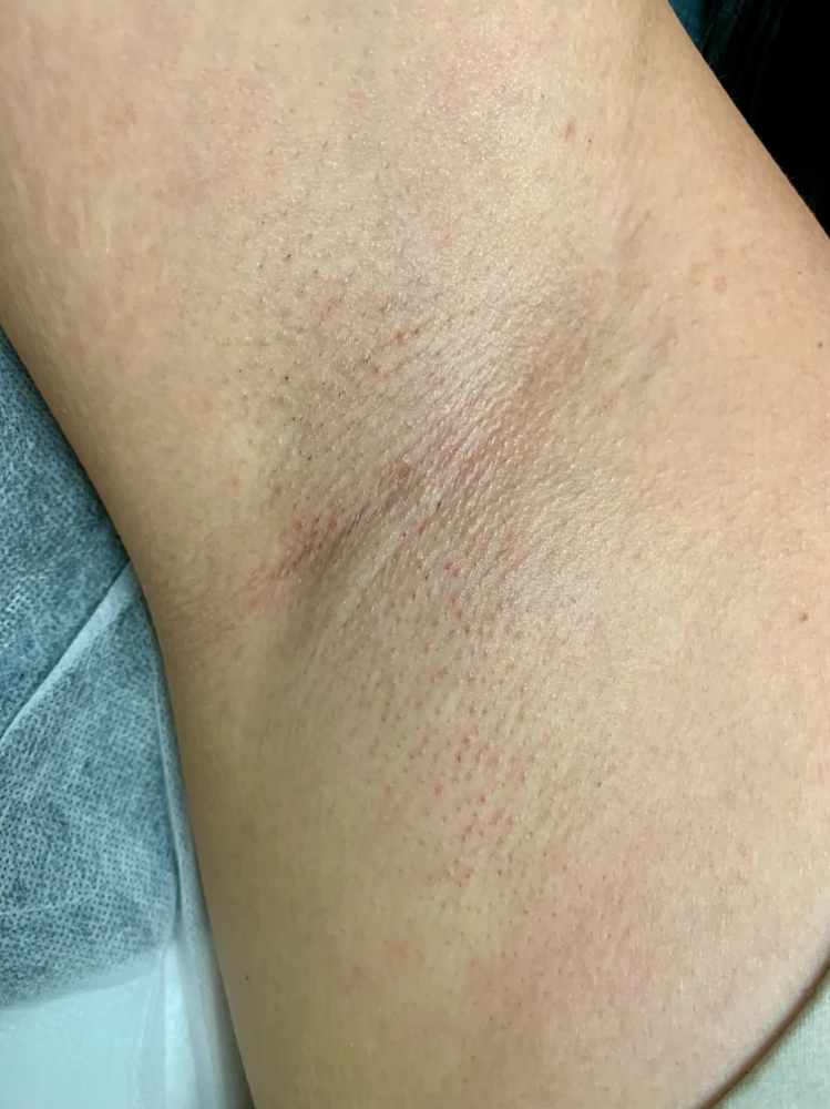 Underarm Waxing