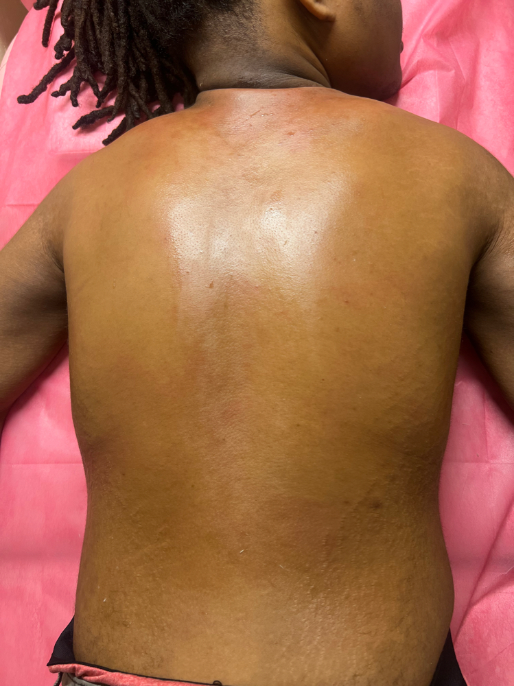 Back Wax