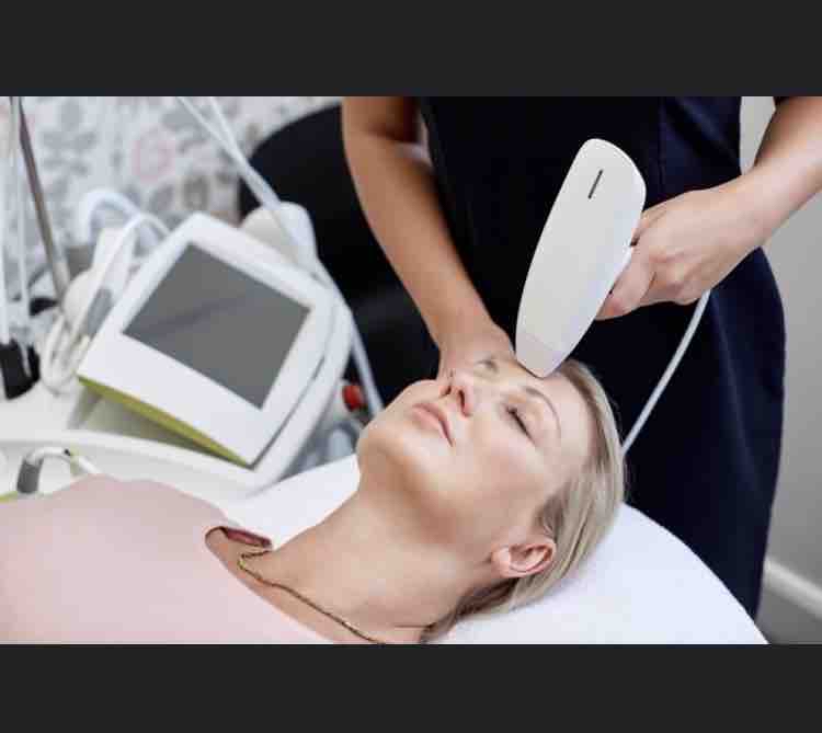 Viva Fractional RF - Face And Neck