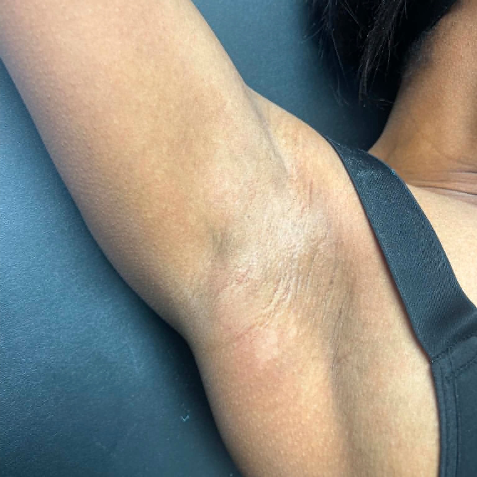 Underarms at Crown Of Essence Hair Studio in COLUMBUS, GA