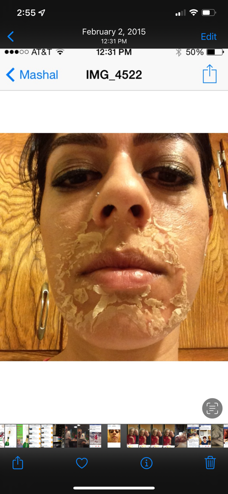 Signature Peel