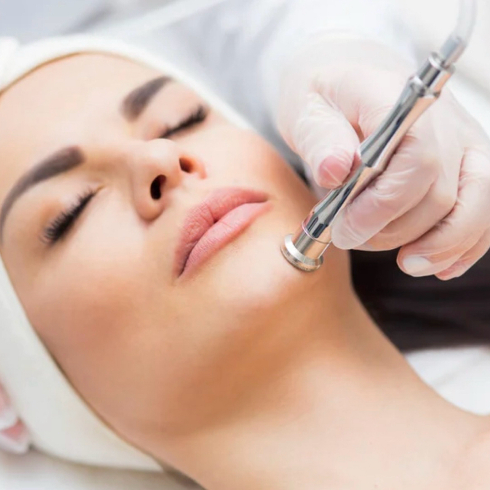 Microdermabrasion Facial at Esthetically Yours, Erica in Claremont, CA