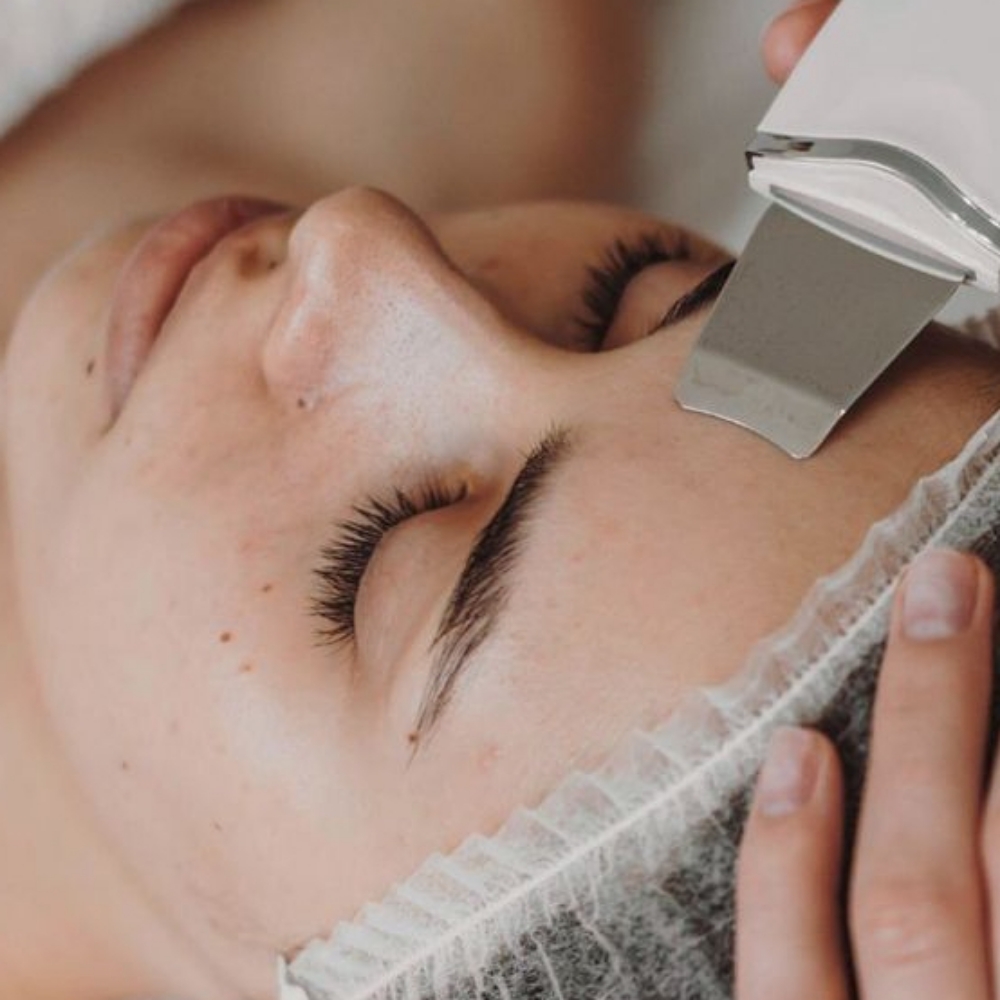 Skin Resurfacing & Pore Facial at ULTRA LUX MED SPA in Myrtle Beach, SC