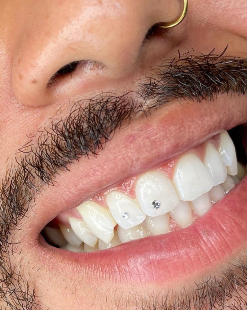 Tooth Gems