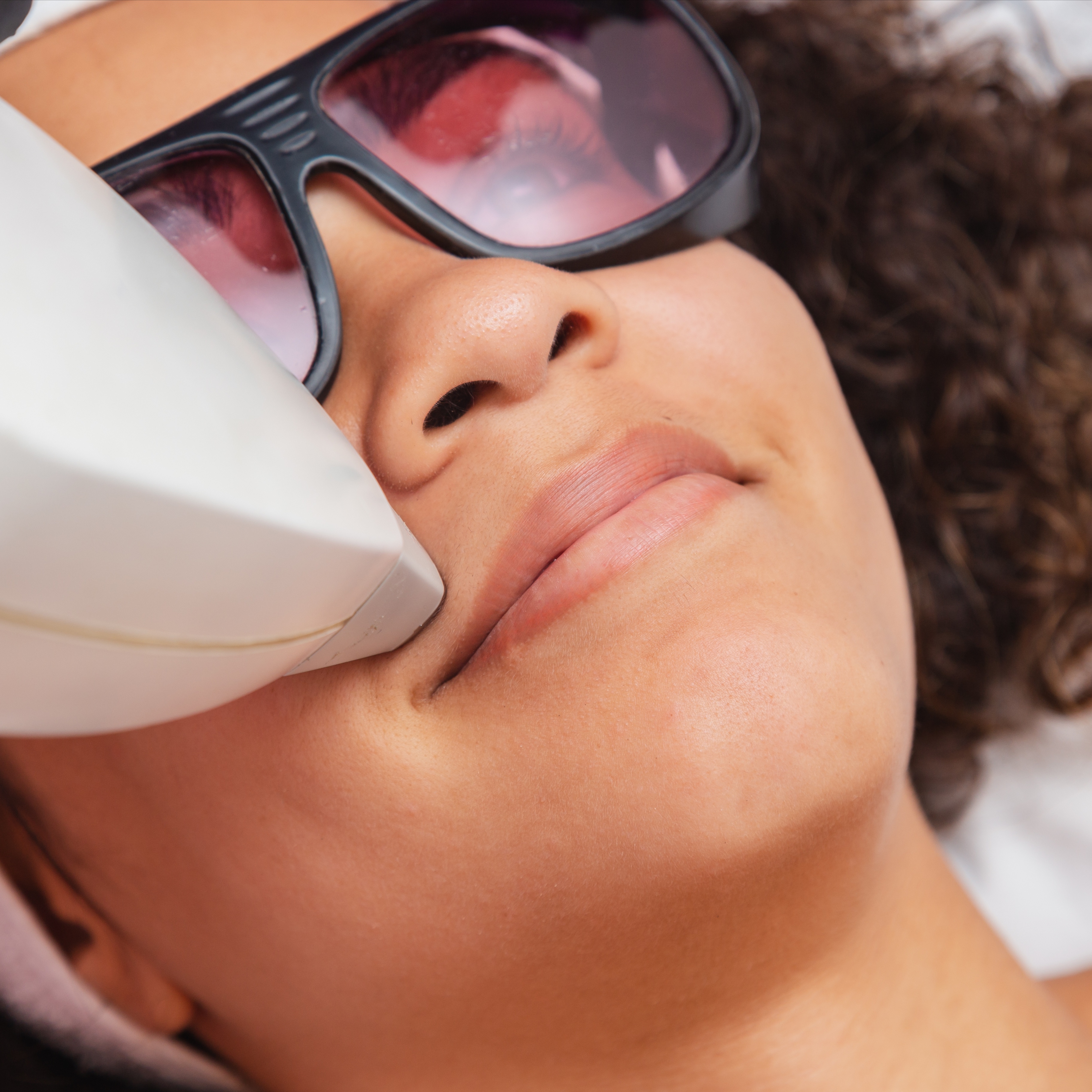 Skin Rejuvenation Laser Facial at 360 Med Spa Buford in Buford, GA