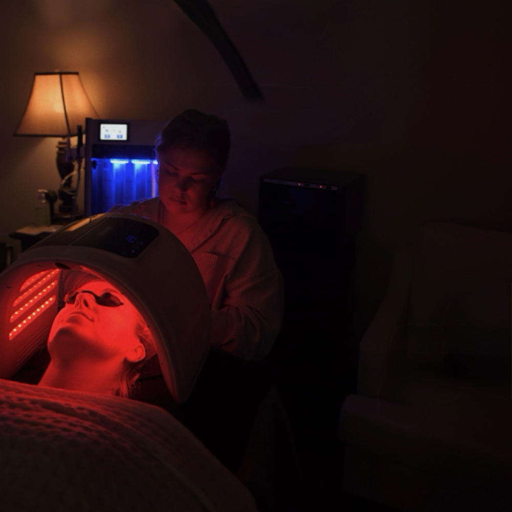 Rosacea Relief Facial at Kind Skin by Jess in London, KY