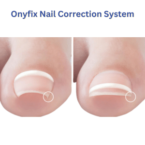 Dry Pedicure + 1 Onyfix