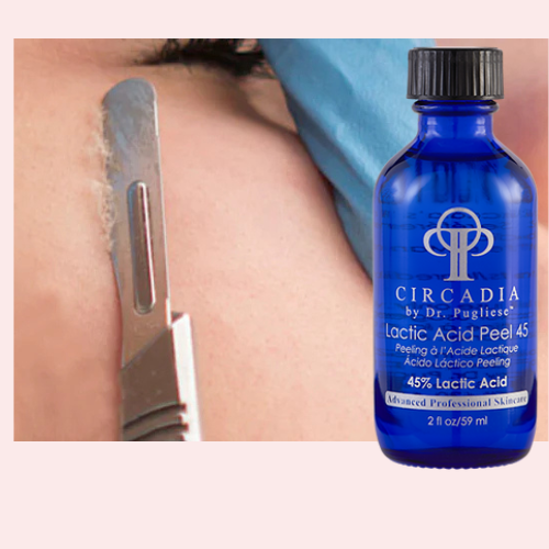 Dermaplane + Gel Base Peel