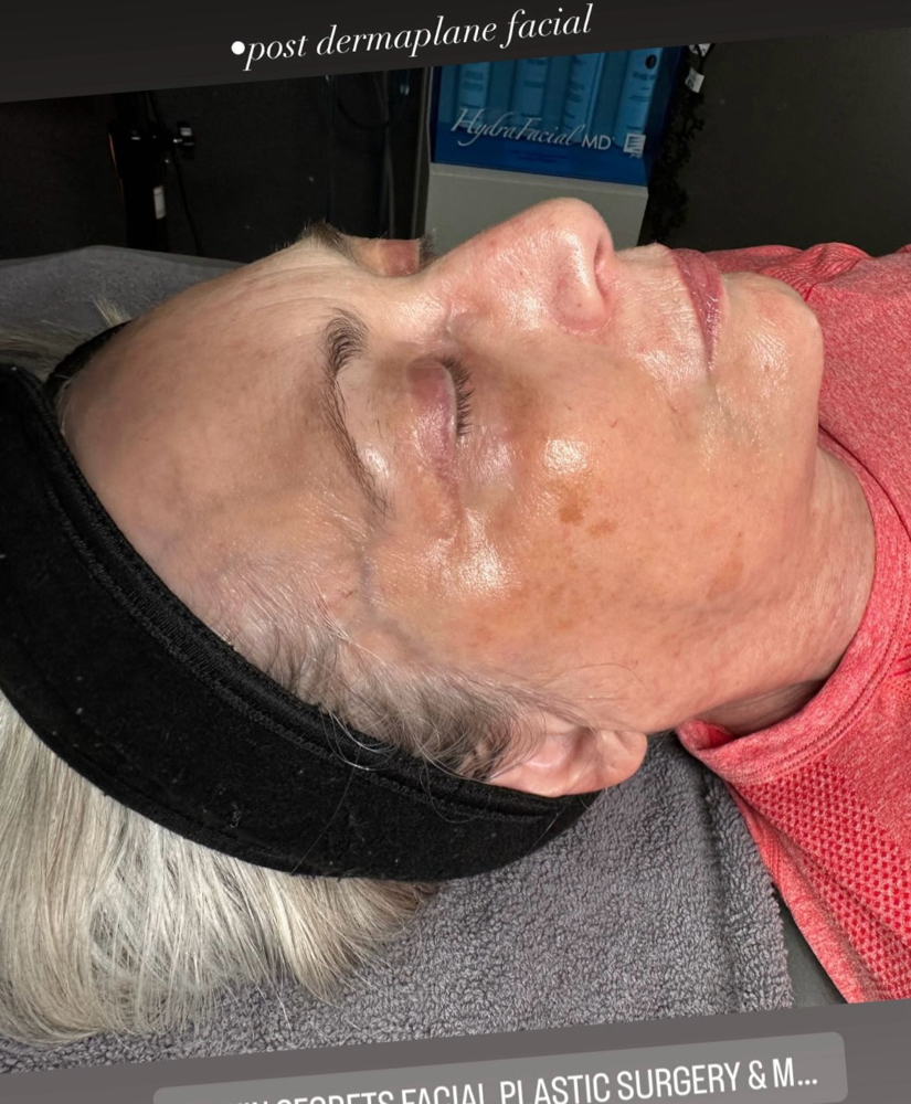 Anti- Aging Facial