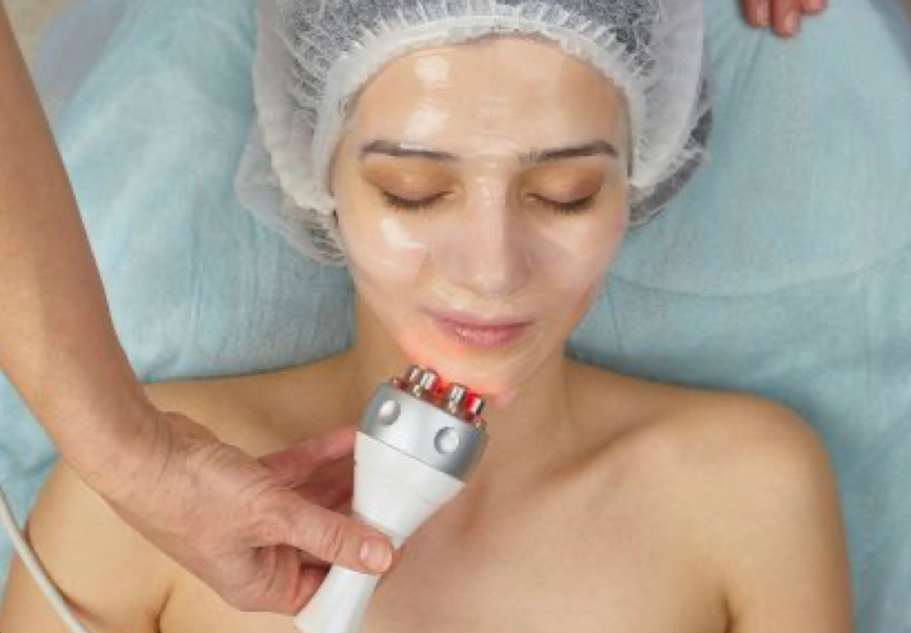 Radiofrecuencia Facial Multipolar