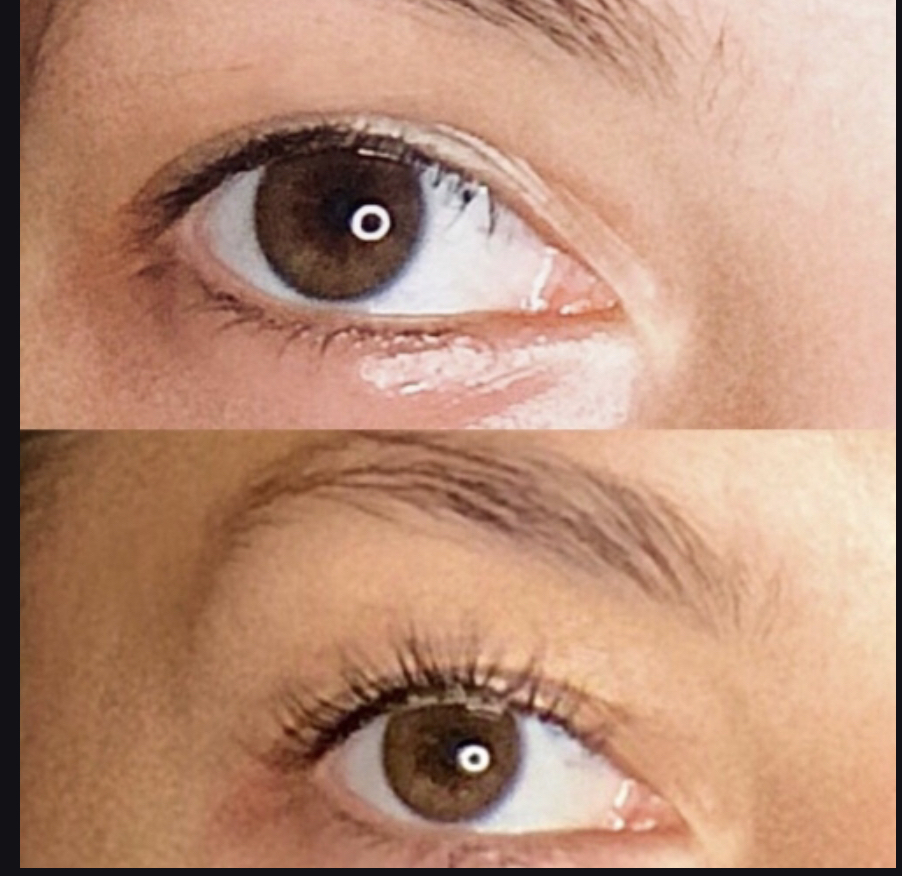 Lash Lift